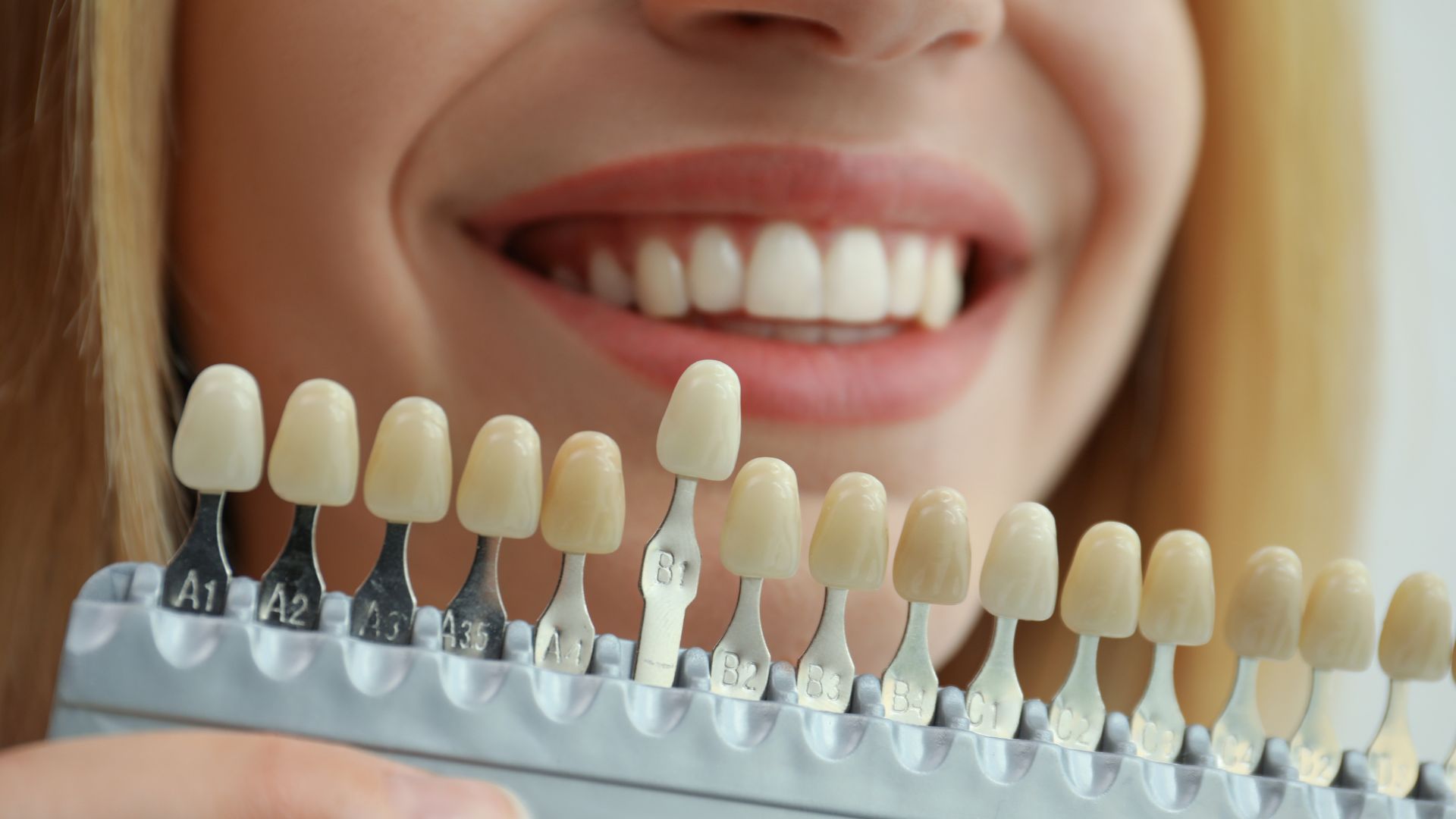 How Aesthetic Dentistry in Mar Vista Supports a Long Term Smile Confidence