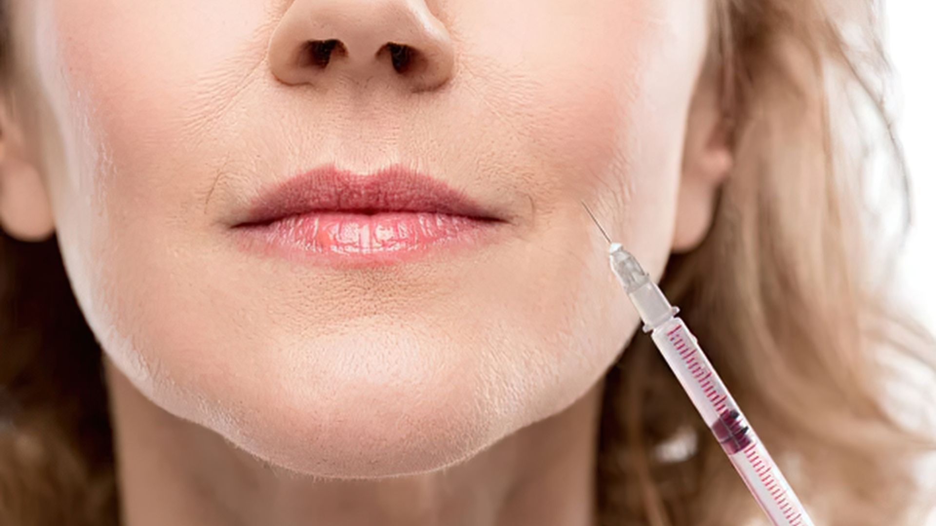 How Dental Botox in Playa Vista Helps With Jaw Clenching And Muscle Tension