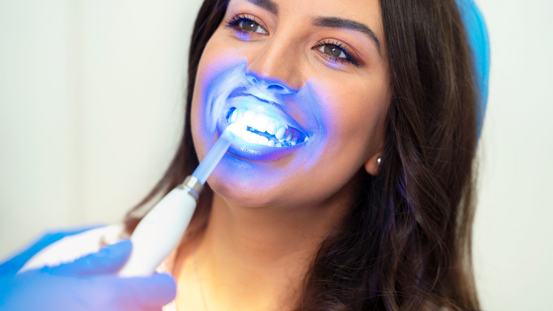 How To Know If You Are A Good Dental Candidate For Teeth Whitening