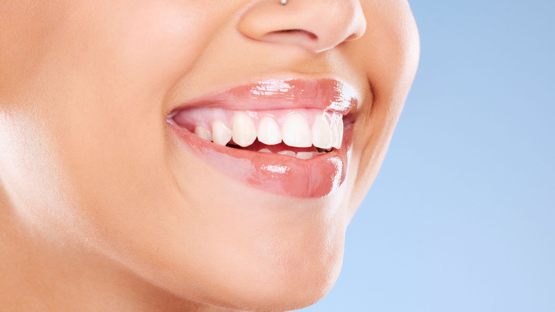 What To Expect Before And After A Whitening Dental Appointment