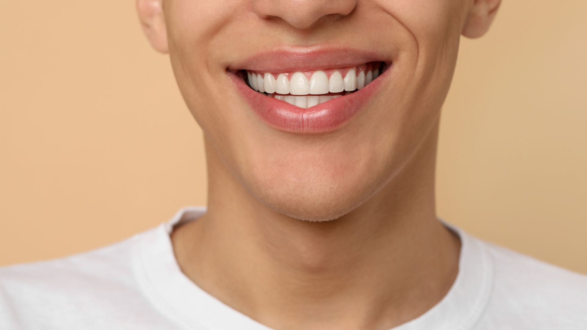 Composite Bonding Versus Porcelain Veneers in Playa Vista - We’ll Help You Decide with a Consultation Image