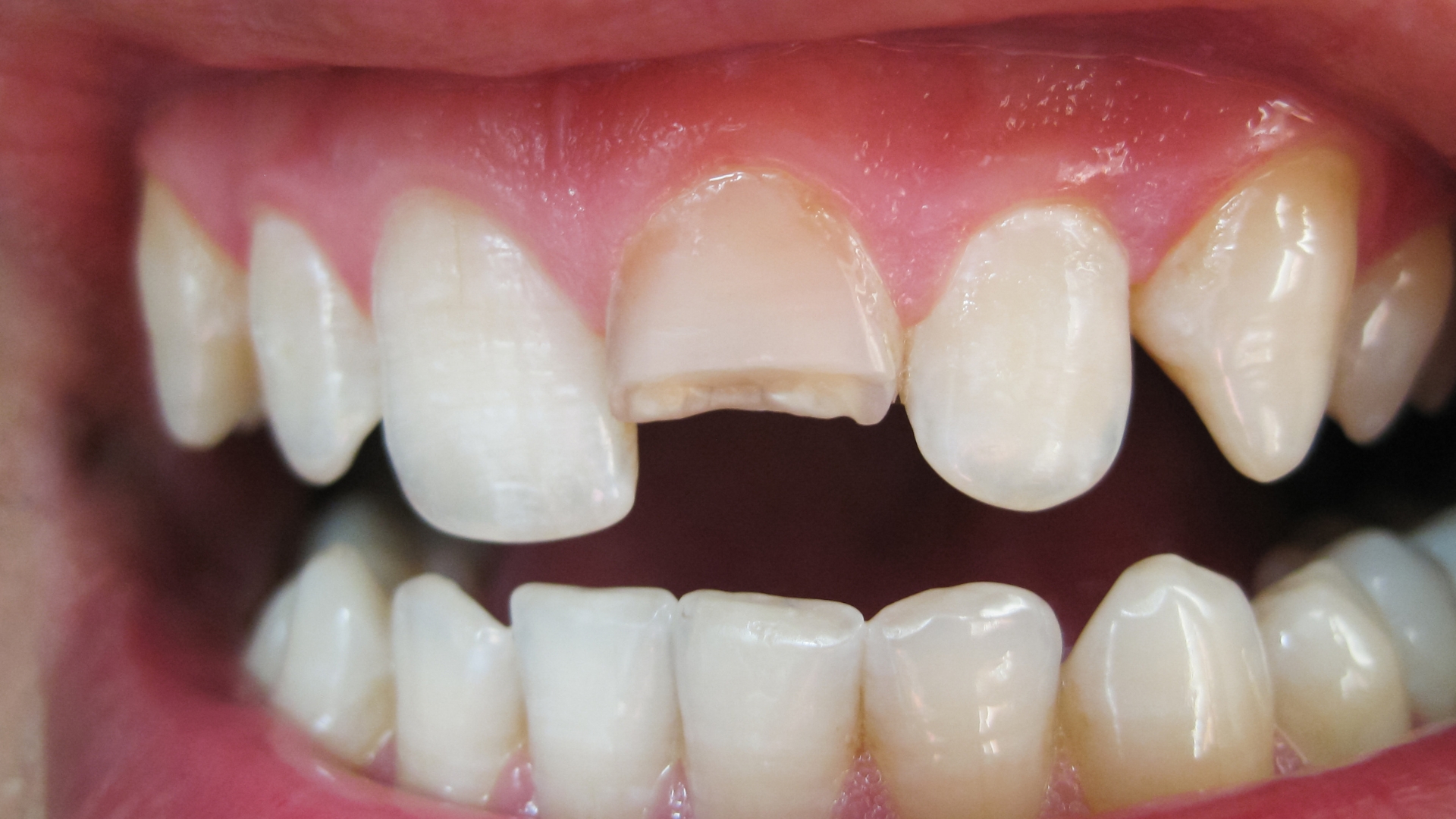How Can a Cosmetic Dentist in Playa Vista Help With Stains, Chips, and Gaps