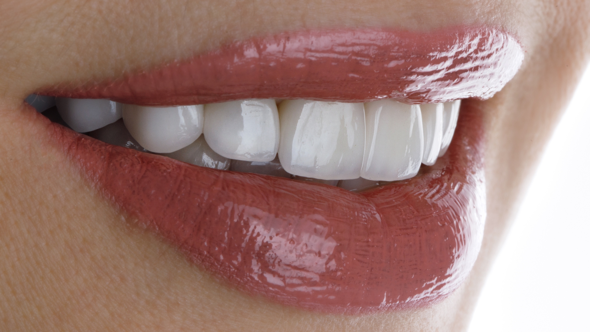 How Do I Compare Veneers, Whitening, and Bonding With a Playa Vista Cosmetic Dentist