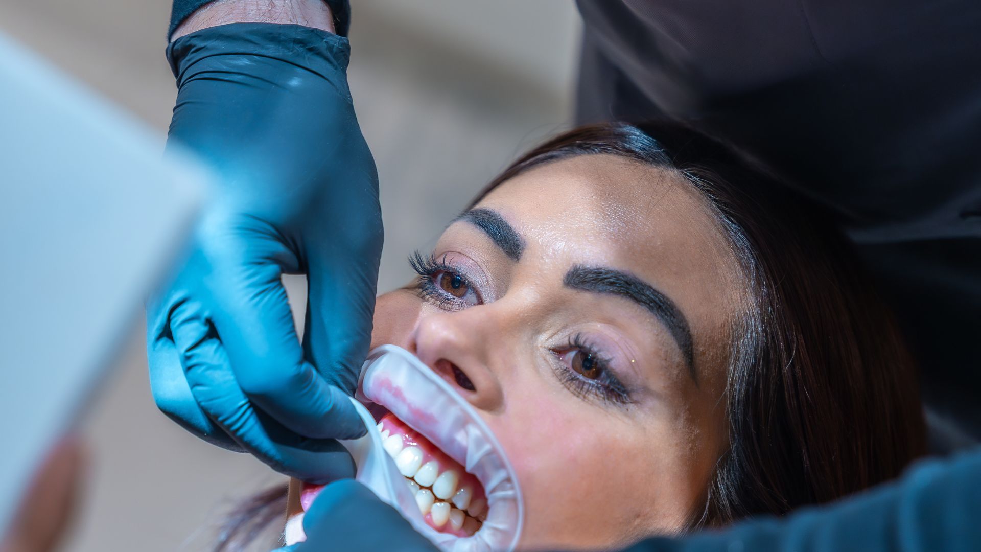 Schedule Teeth Whitening in Del Rey With Westside Aesthetic Dentistry Image