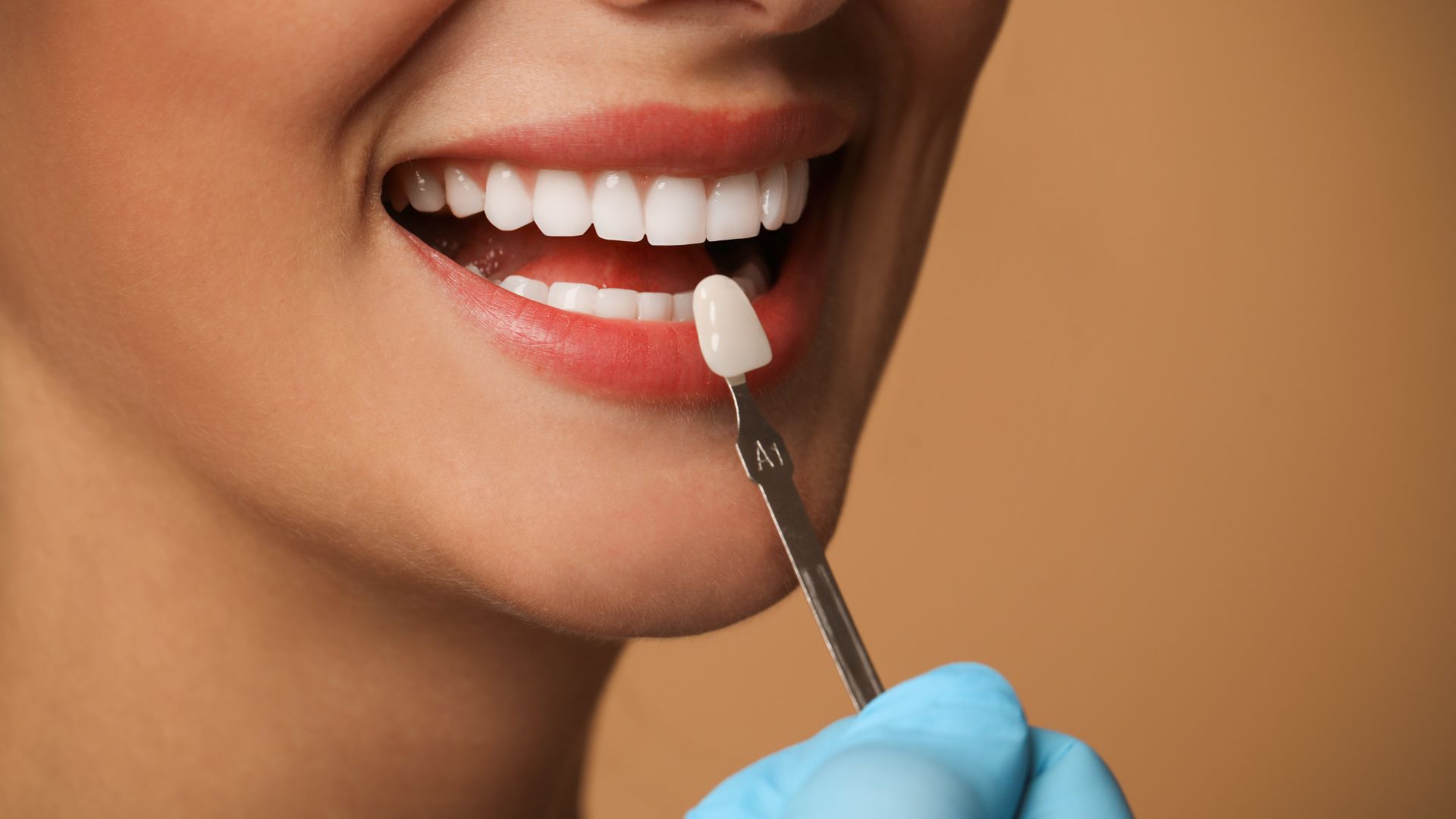 Schedule a Veneers for Gaps in Playa Vista Consultation Today - Call Us Image