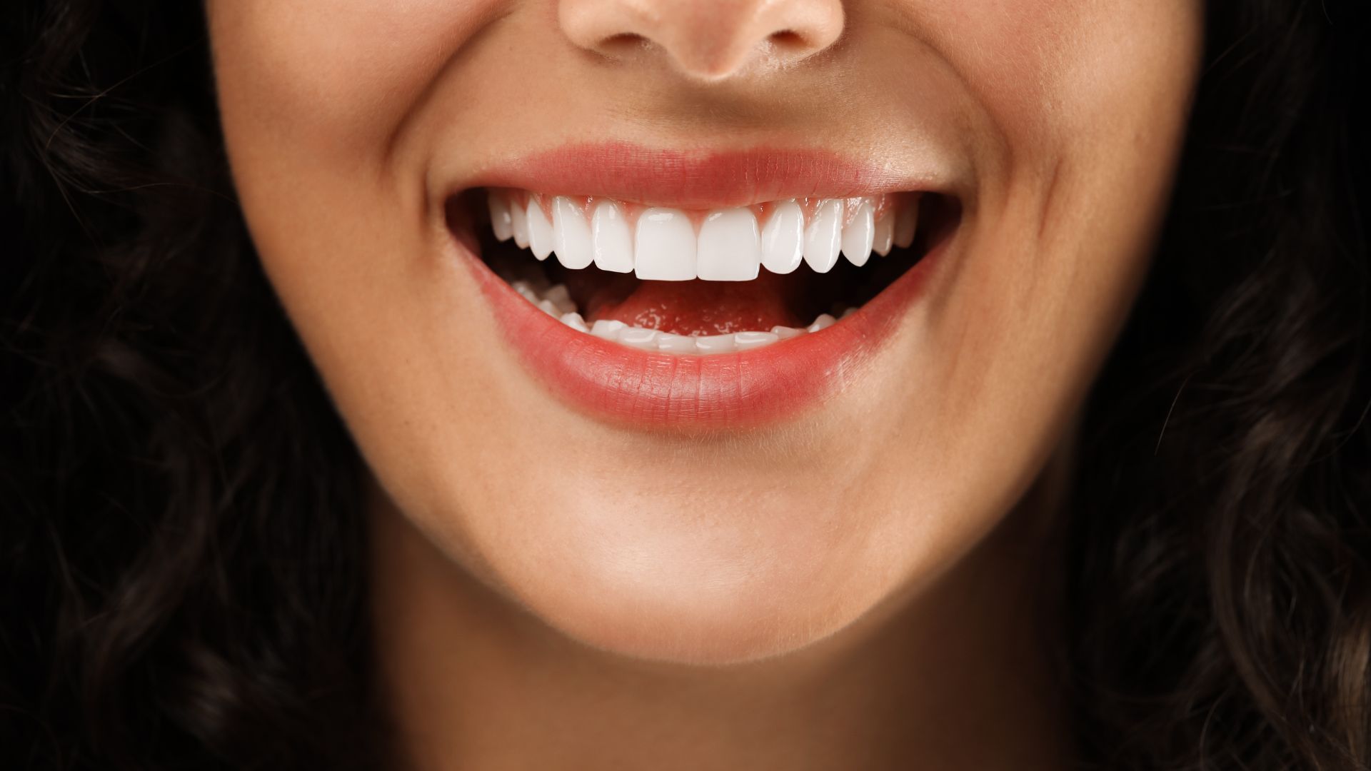 Porcelain Veneers in Playa Vista for Natural-Looking Teeth Image