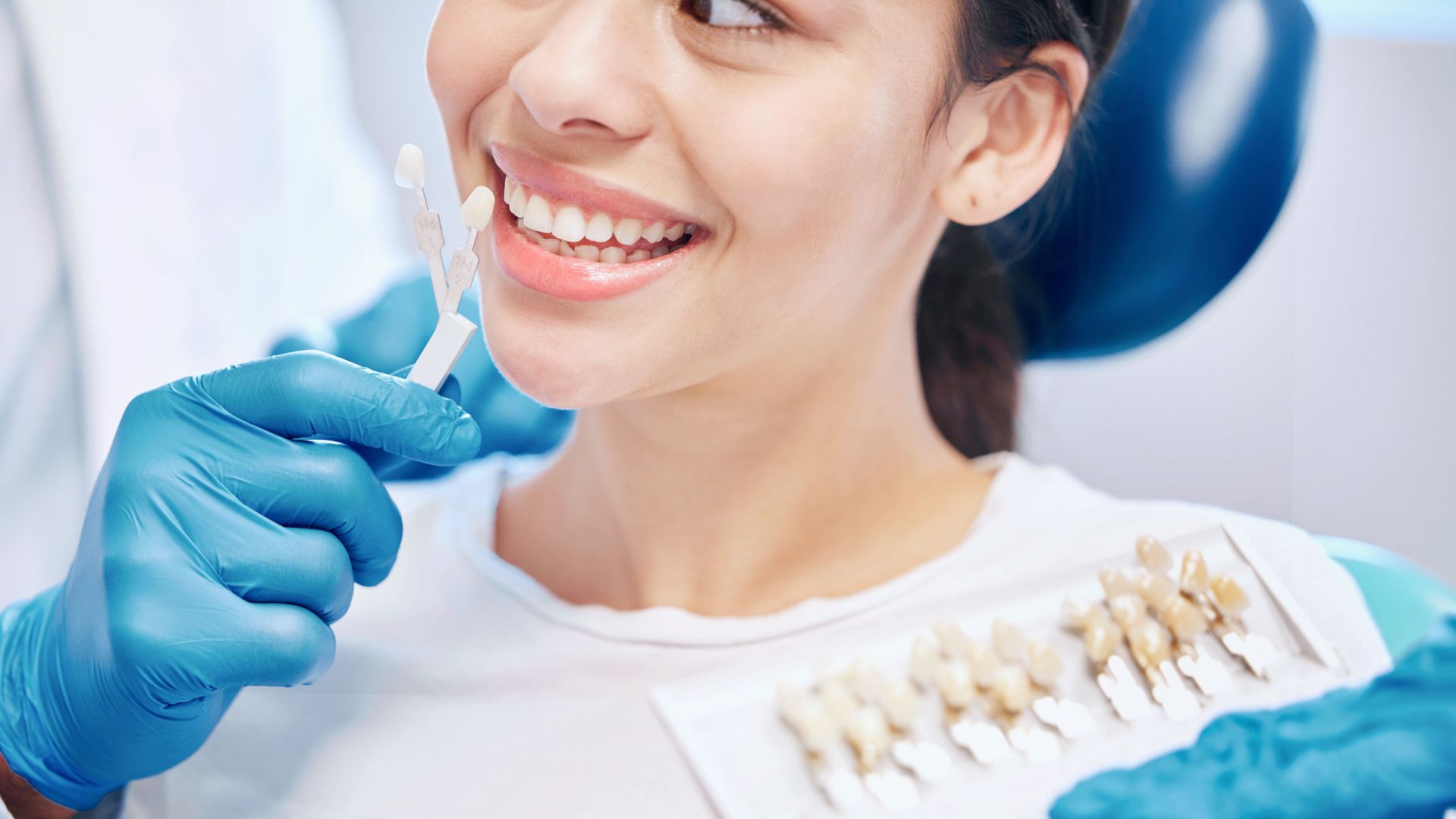 What to Expect During a Veneer Consultation in Playa Vista Image