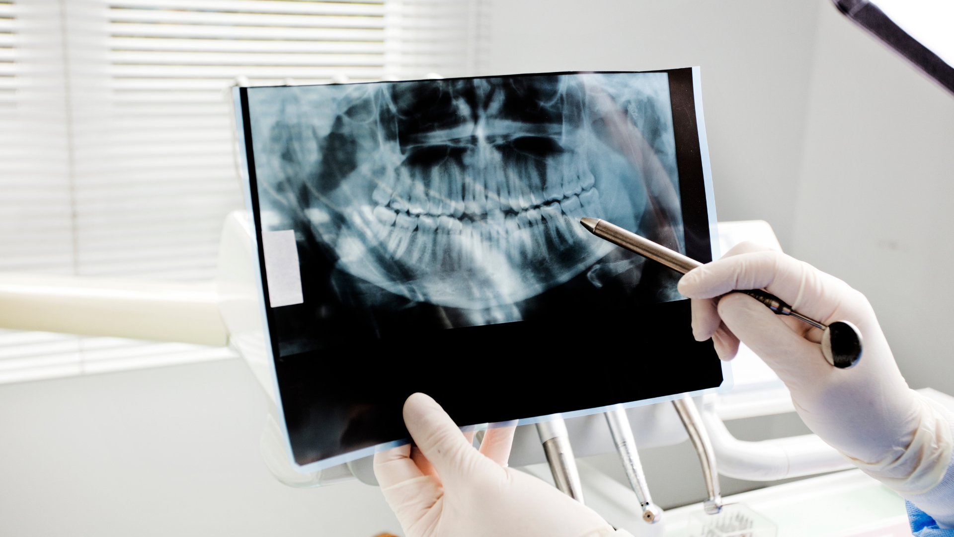 What Happens During an Airway Dentistry Evaluation in Playa Vista