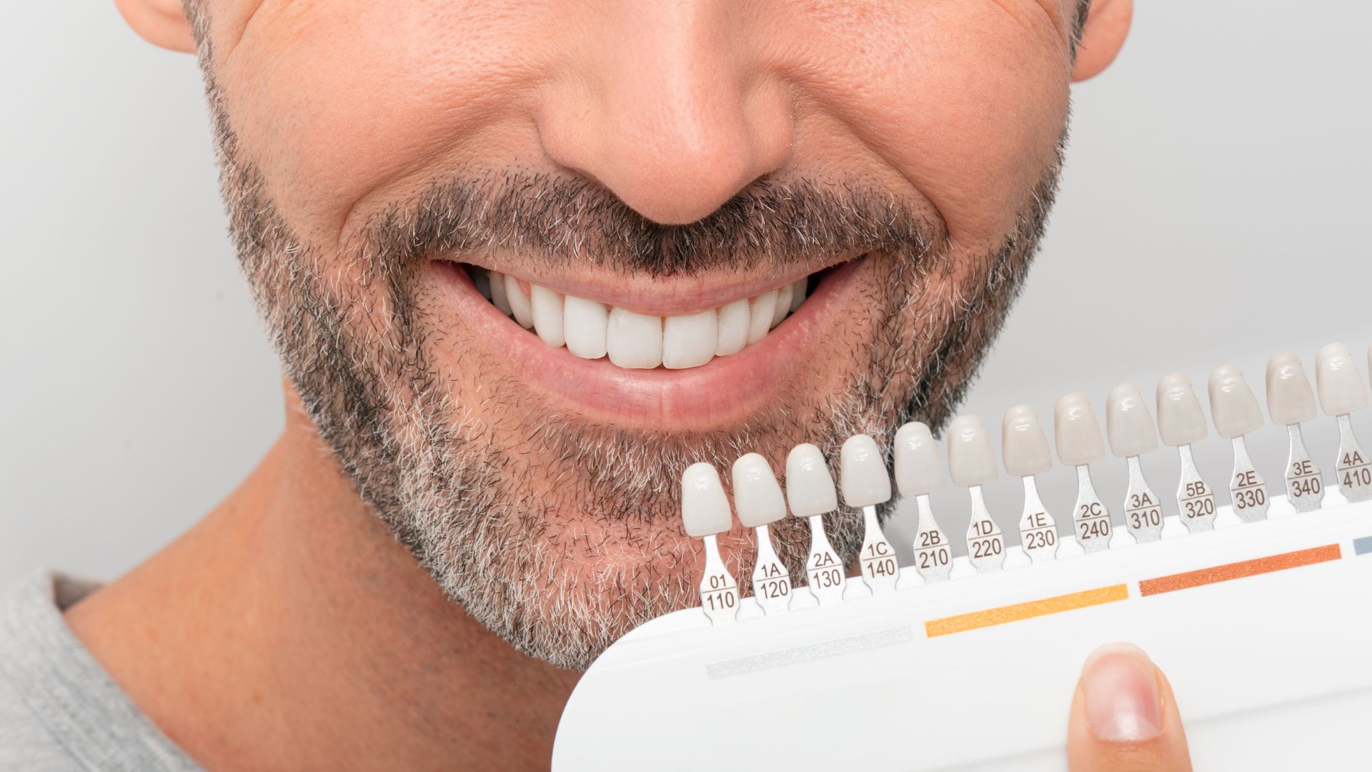 Why Coffee Stained Teeth Need Professional Whitening Planning in Playa Vista, California