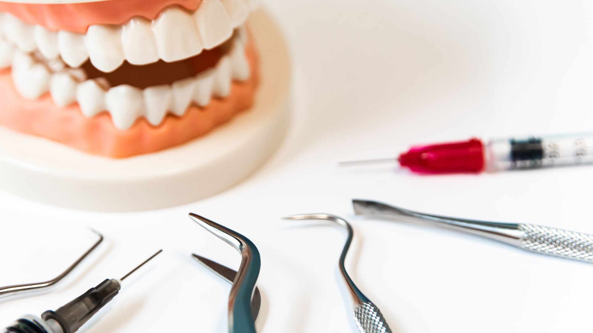 Why Periodontal Maintenance in Playa Vista Matters After Gum Treatment