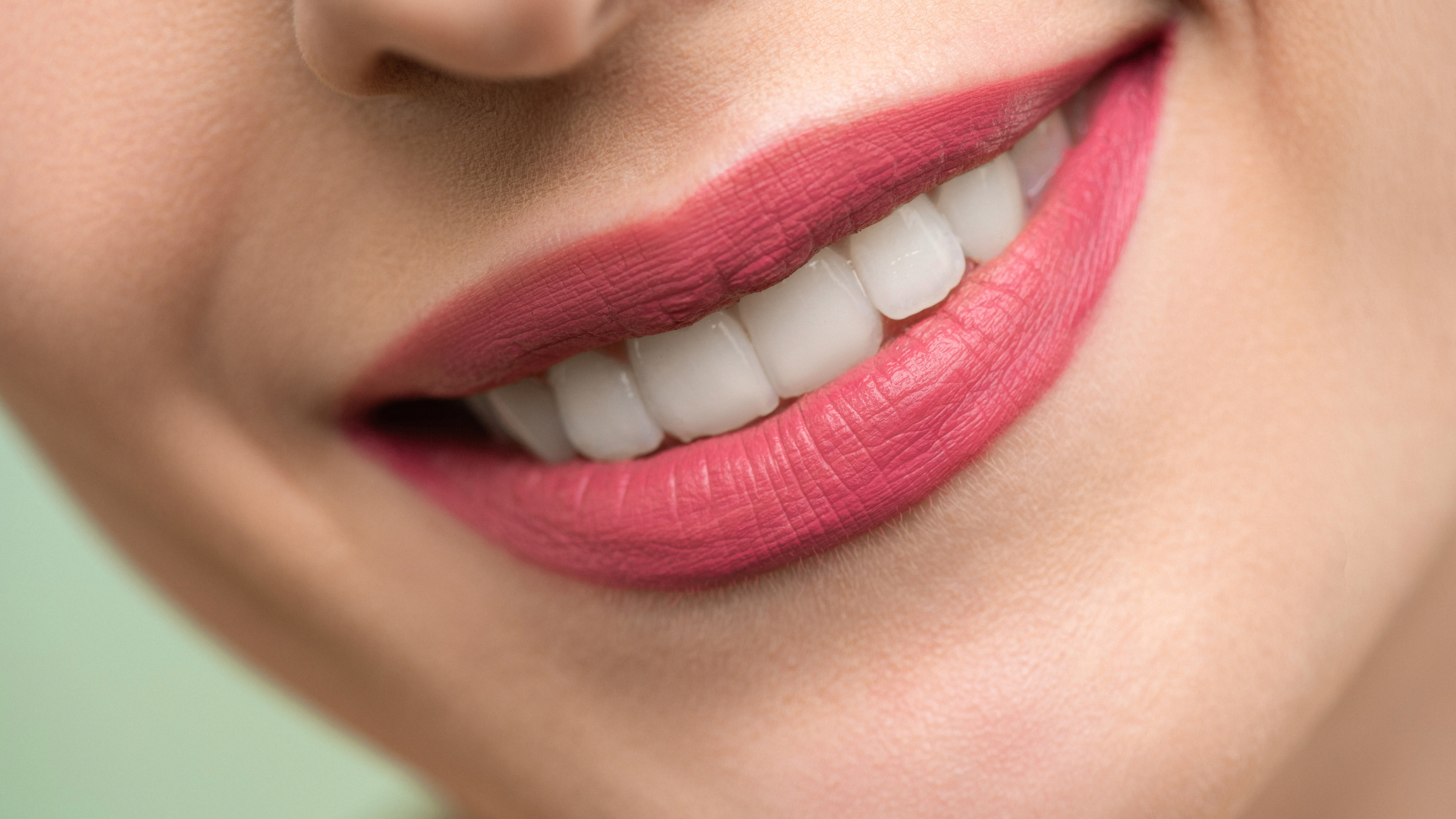 How Teeth Whitening Can Improve Your Confidence and Smile
