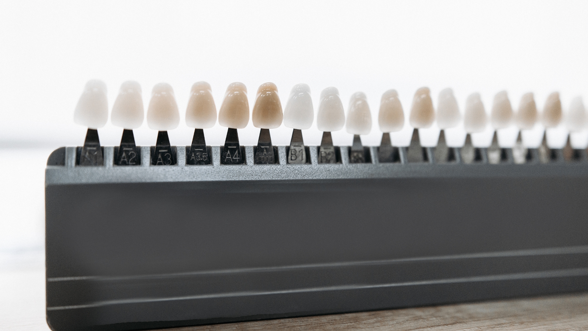 What Should You Ask During a Veneer Consultation in Playa Vista