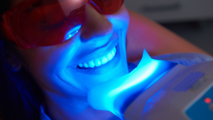 What to Expect During a Teeth Whitening Appointment in Los Angeles