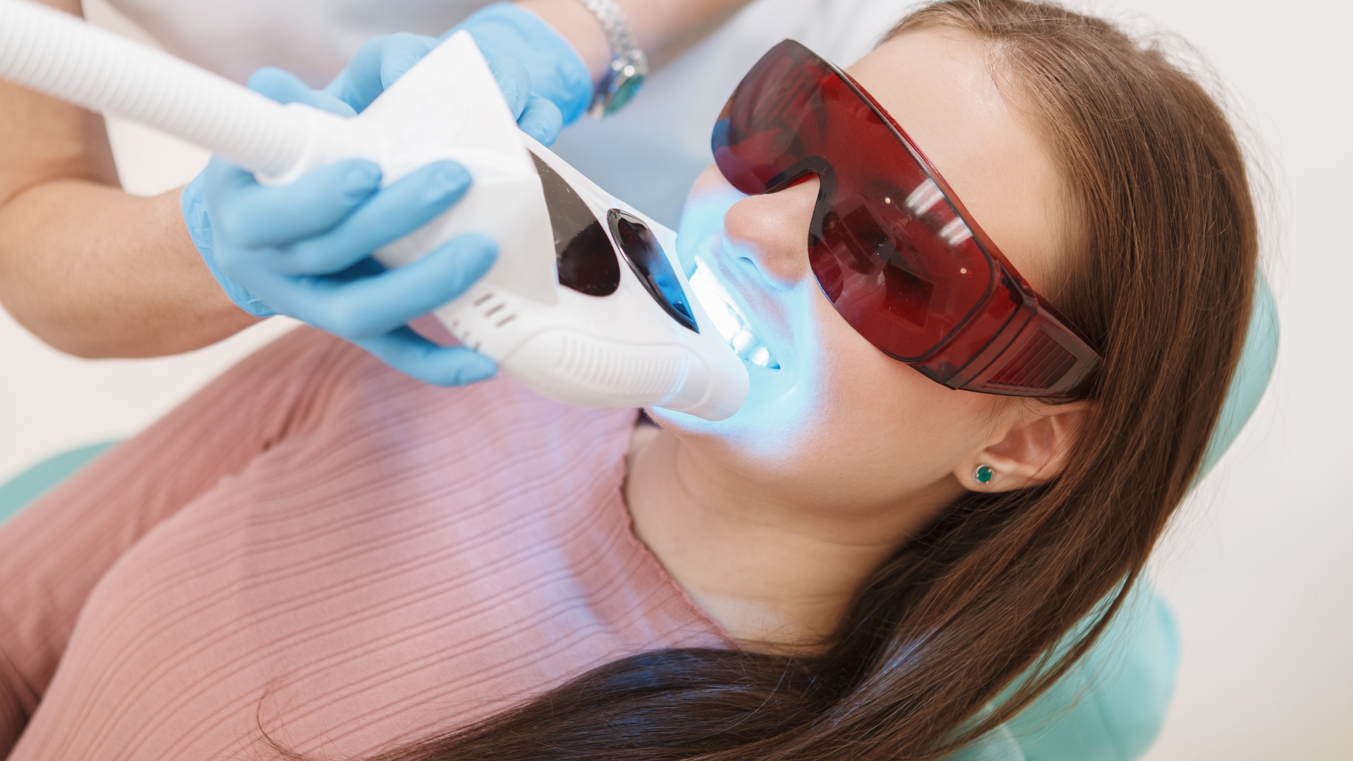 Why Composite Bonding Does Not Whiten Like Natural Teeth