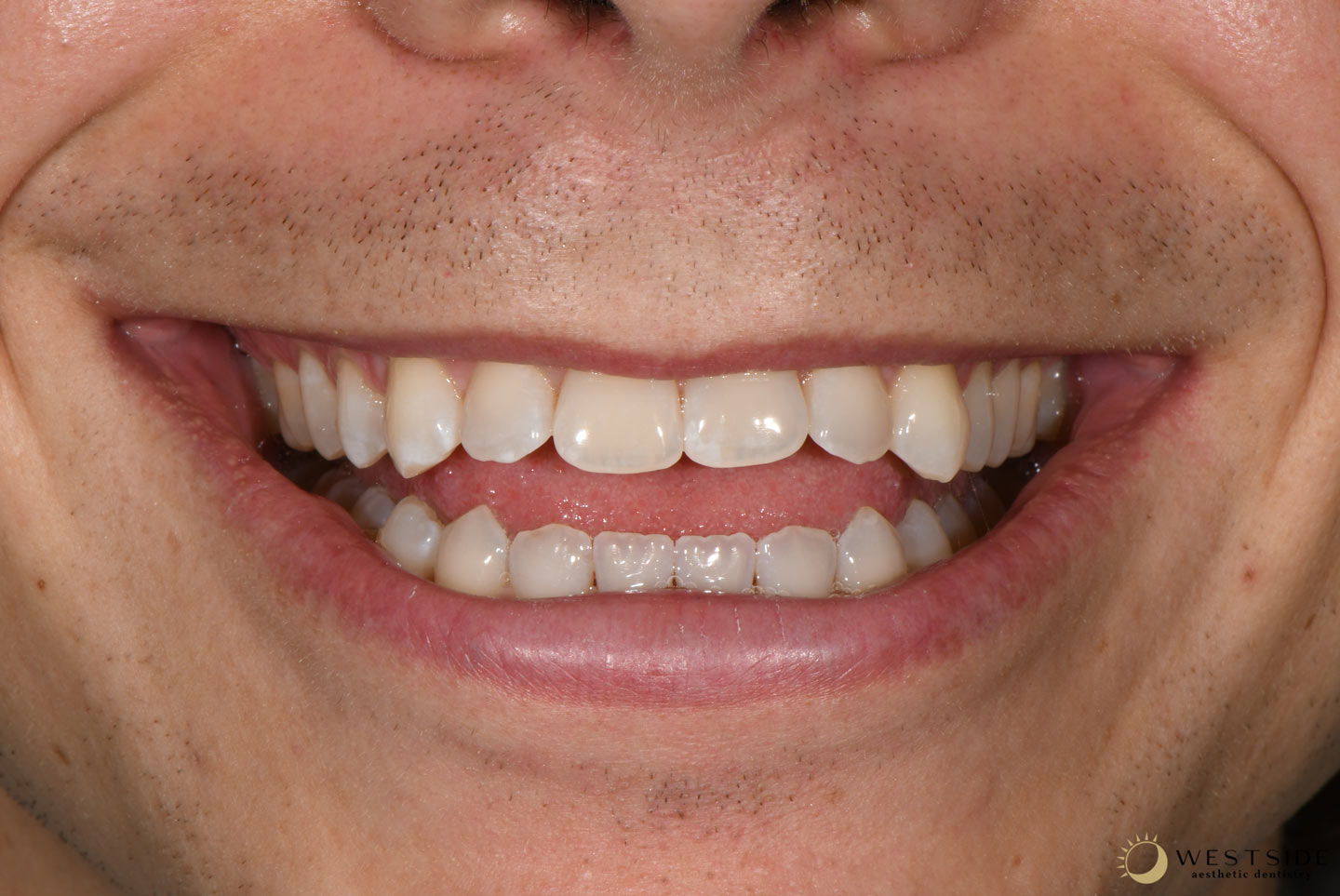 Westside Aesthetic Dentistry After